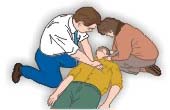 Person Being Resuscitated